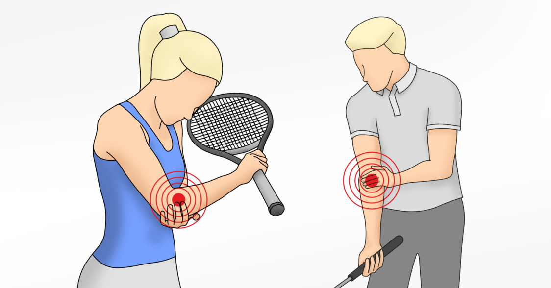 Where does tennis or golfer's elbow hurt? 