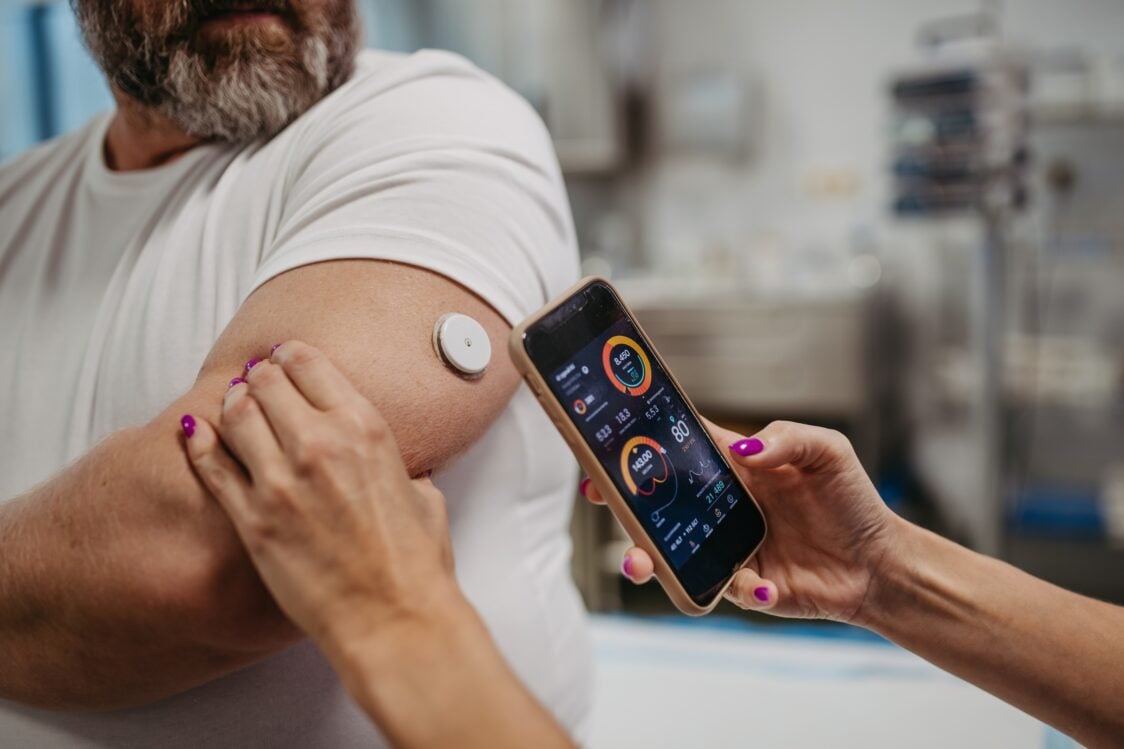 Function of glucose monitors
